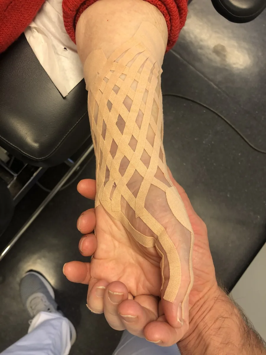 Kinesiotaping av albue