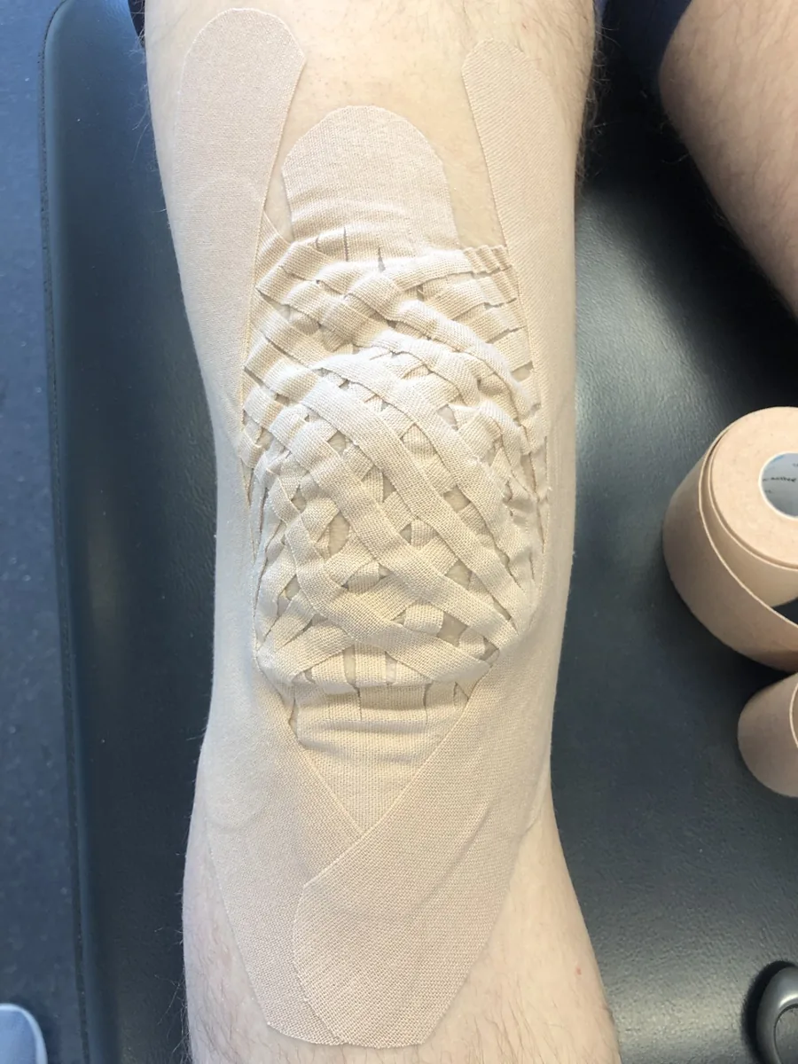 Kinesiotaping av kne