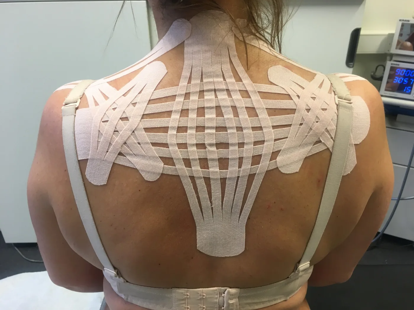 Kinesiotaping av nakke og skuldre