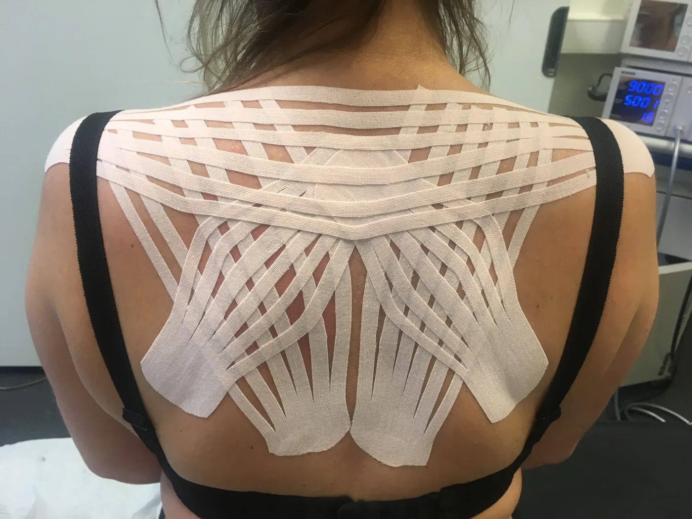 Kinesiotaping av rygg og skuldre
